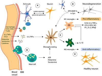 Outside in: Unraveling the Role of Neuroinflammation in the Progression of Parkinson's Disease